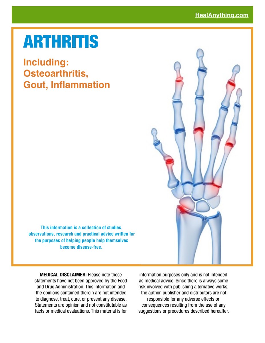 ARTHRITIS: Osteoarthritis, Gout, & Inflammation (86 page e-booklet)