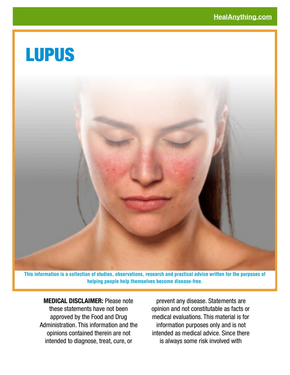 LUPUS (53 page e-booklet)