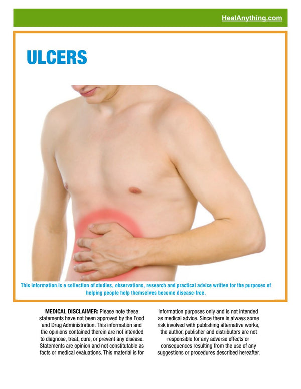 ULCERS (40 page e-booklet)